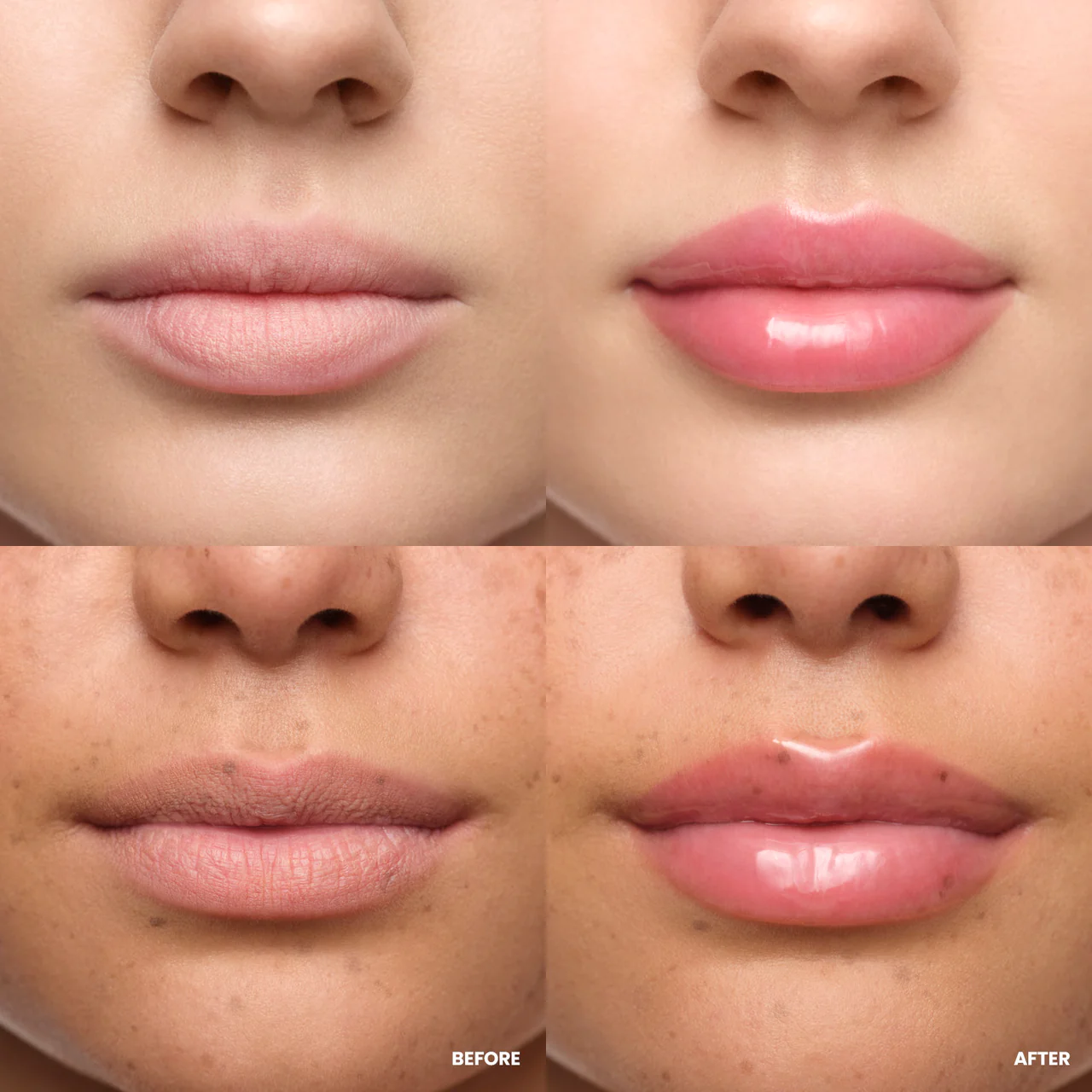 Wonderskin Lip Rehab Serum Oil clear - Billede 2
