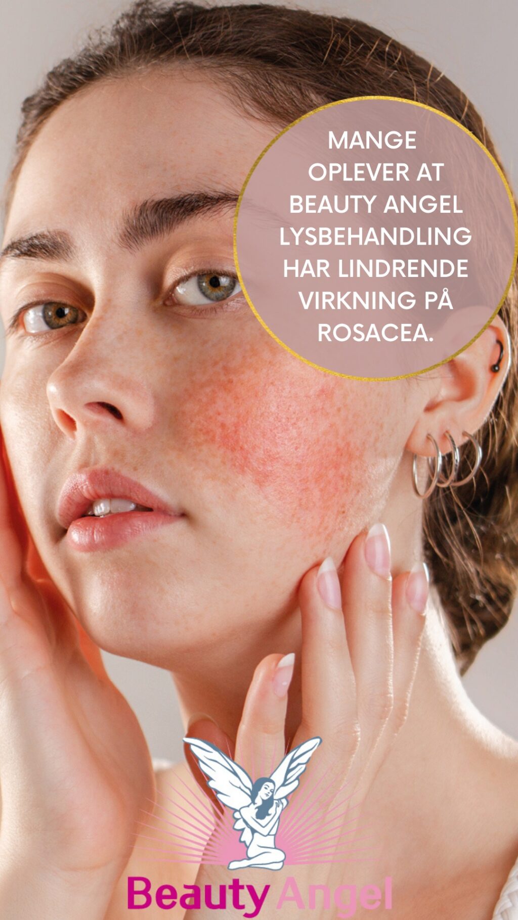 Instagram post from gitte_gylvig_skin_and_wellness. This post is in position 4.