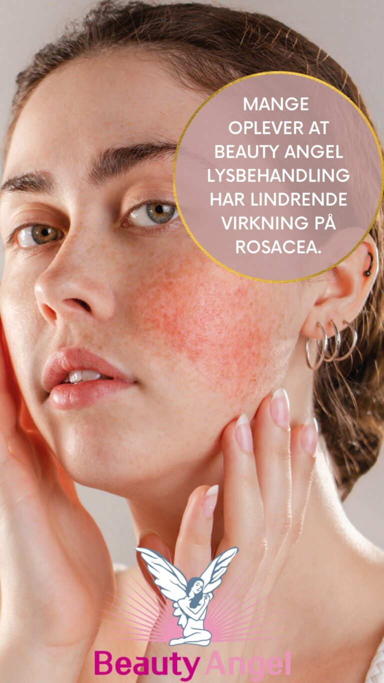 Instagram post from gitte_gylvig_skin_and_wellness. This post is in position 5.